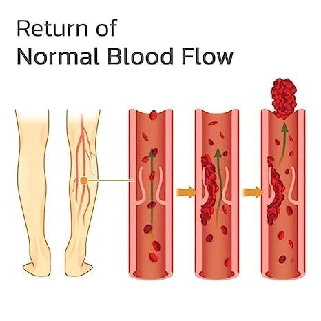 Varicose Veins Patches