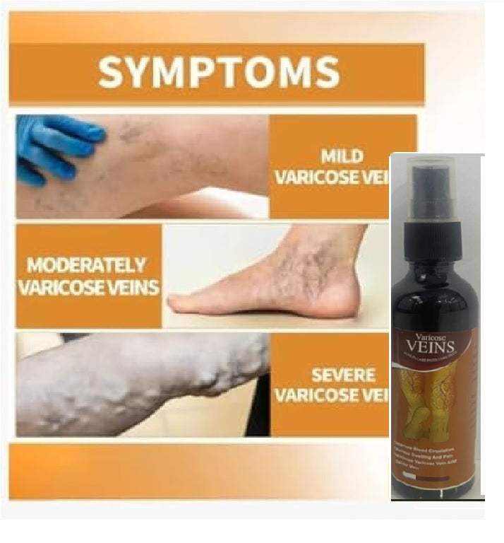Varicose Veins Spray