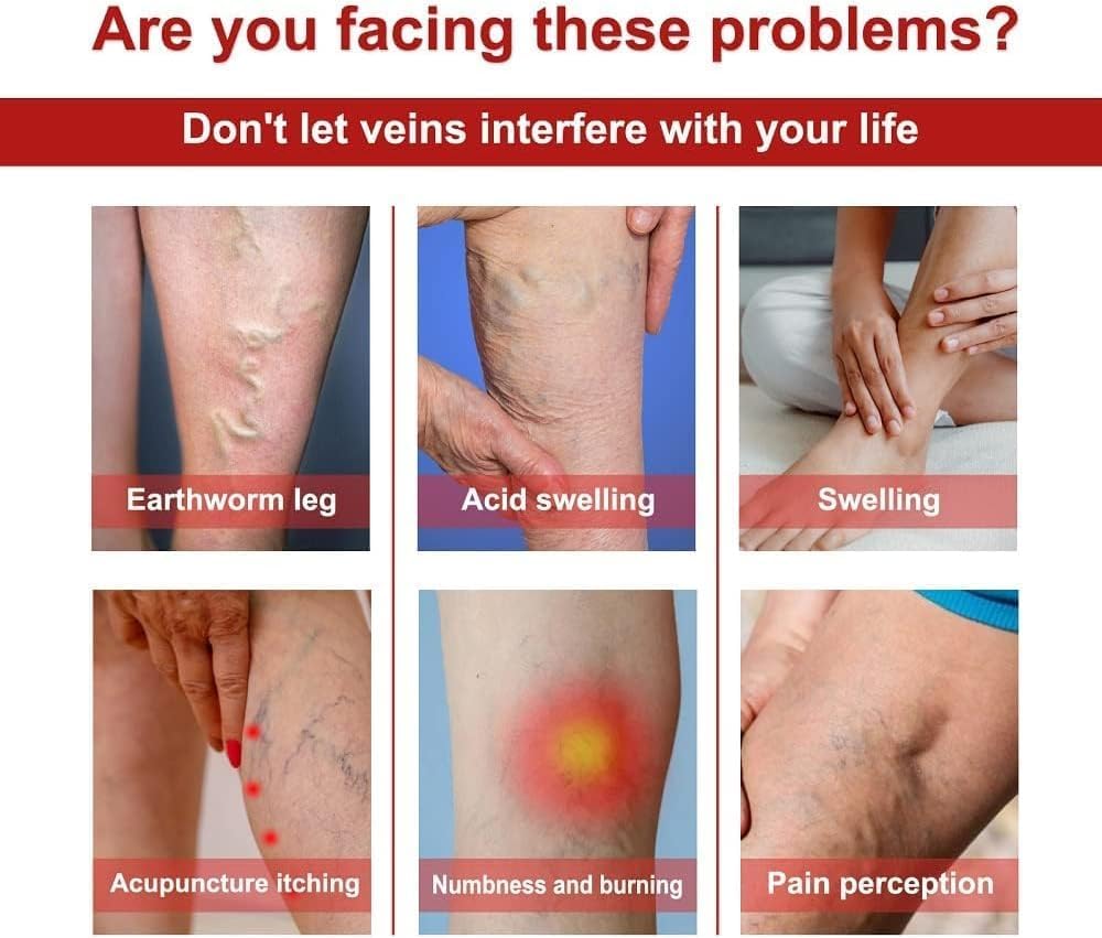 Varicose Veins Patches