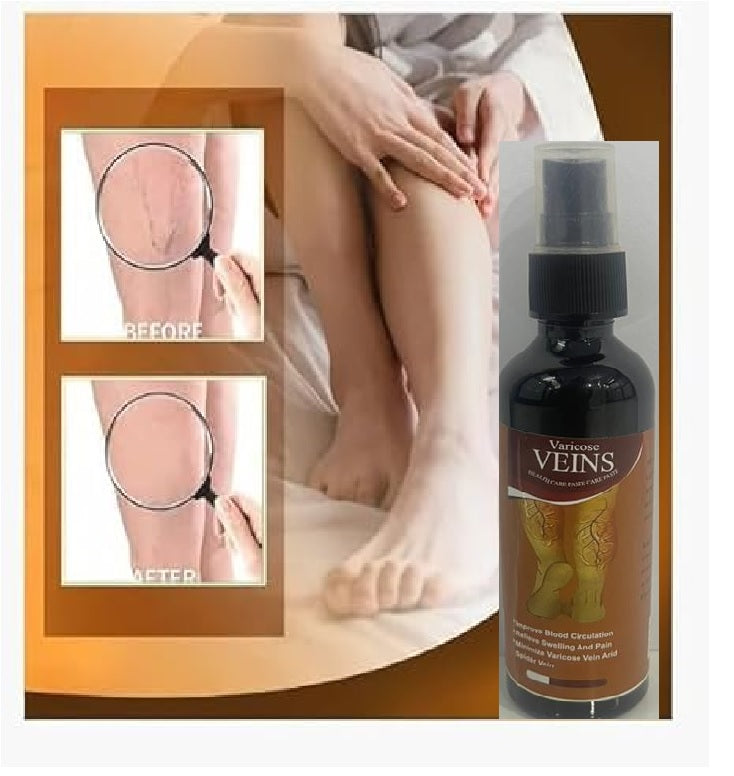 Varicose Veins Spray