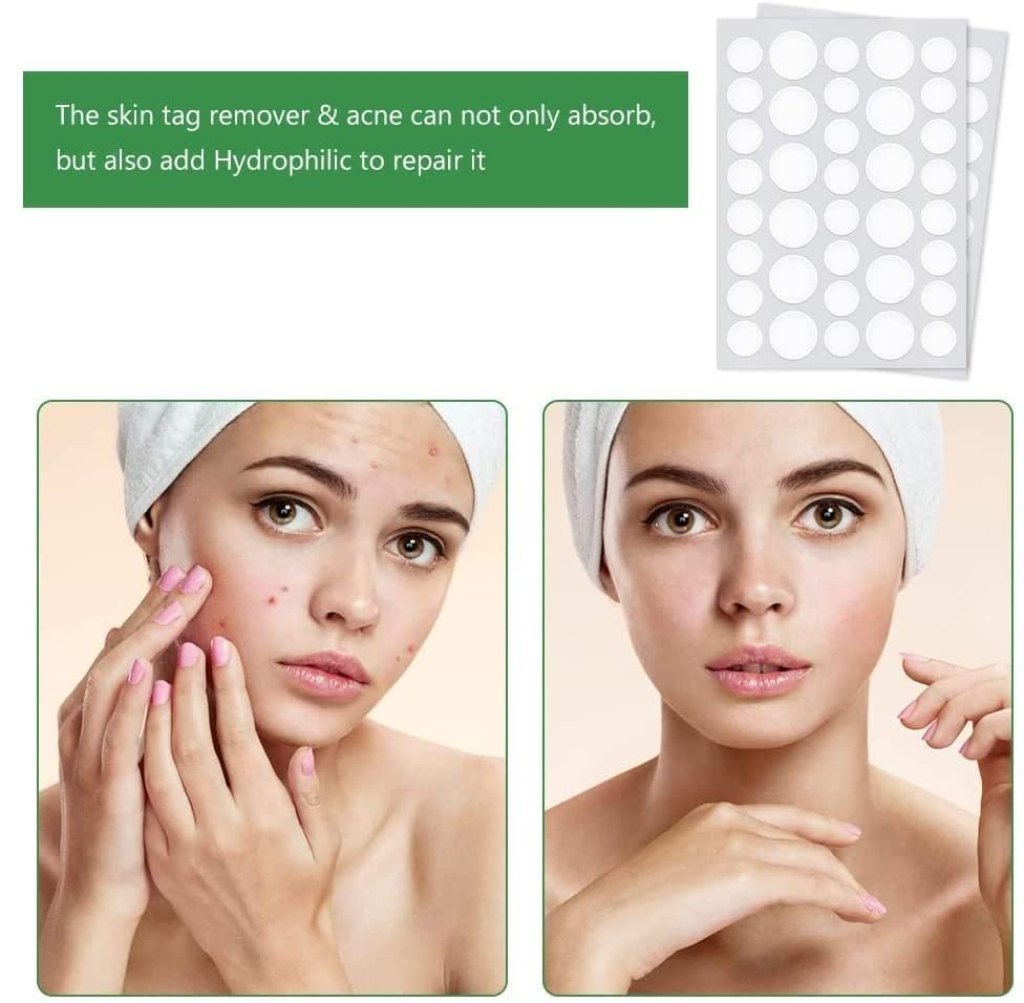 Acne Pimple Patch (36 Pcs)